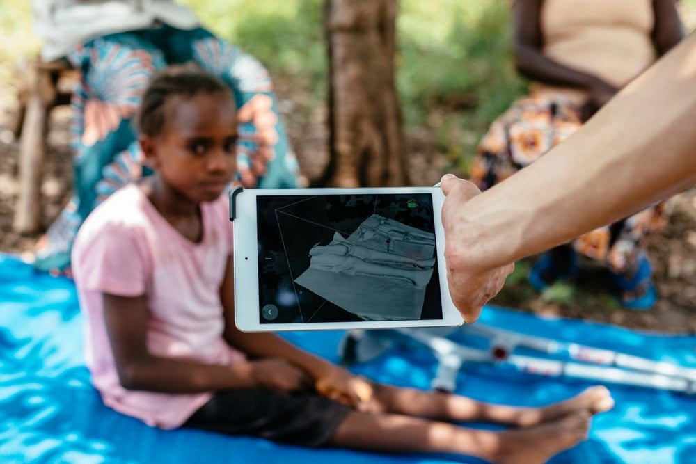 En Ouganda, la jeune Tabita, victime de la polio à 3 ans, bénéficie grâce à Handicap International de la technologie 3D pour la réalisation d'orthèses qui l'aideront à marcher.